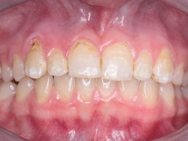 FC a ICON VESTIBULAR